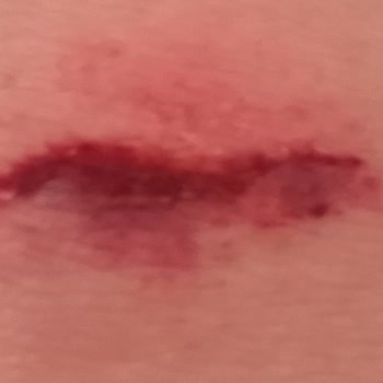 Milli Eğitim Bakanlığı (MEB) Okul Önünde Torpil Patlatma