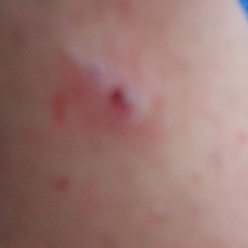 Milli Eğitim Bakanlığı (MEB) Okul Önündeki Tehlikeler