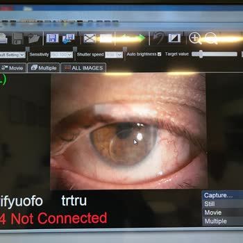 Kocaeli Şehir Hastanesi Göz Doktorundan Şikayetçiyim!