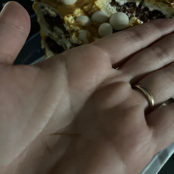 Hemşin Unlu Mamülleri Hijyensiz Ve Kalitesiz Pastane