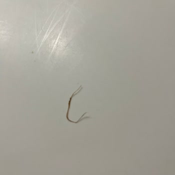 Hemşin Unlu Mamülleri Hijyensiz Ve Kalitesiz Pastane