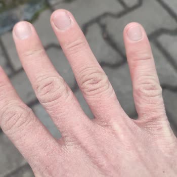 Hobby Şampuan İnsan Eline Zarar Vermesi