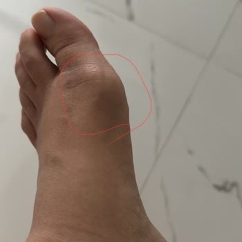 Guess Ayakkabıları Vasat Ayağımı Ameliyatlık Yaptı