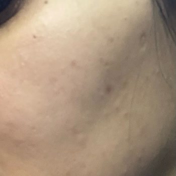 Kiehl's Müşteri Yanlış Bilgilendirmesi