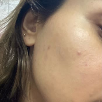 Kiehl's Müşteri Yanlış Bilgilendirmesi