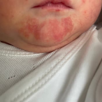 Medicana Hospitals Doğum Deneyimim Hayal Kırıklığına Dönüştü