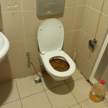 Kırıkkale Üniversitesi Tıp Fakültesi Kırıkkale Tıp Fakultesi WC Gideri Sorunu