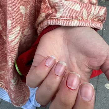 Protez Tırnak Çınare Tırnak İşlemi Hatası