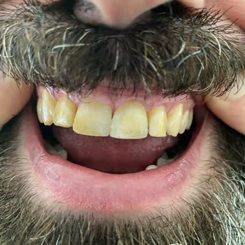 Avrupa Diş Polikliniği Tam Bir Beceriksizlik, Felaket