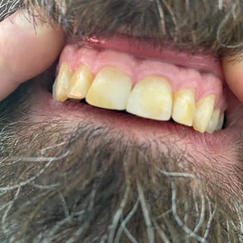 Avrupa Diş Polikliniği Tam Bir Beceriksizlik, Felaket