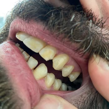 Avrupa Diş Polikliniği Tam Bir Beceriksizlik, Felaket