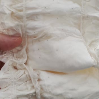Sleepy Bebek Bezi Yabancı Cisim Çıkması