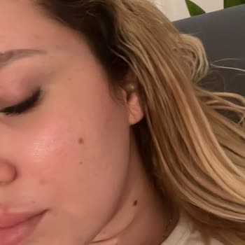 Özel Çankaya Tıp Merkezi (İzmir) Göz Kapak Faciası