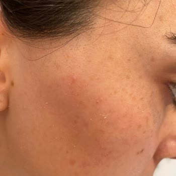 Yves Rocher Ürün Hava Almış