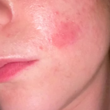 Aktif International Hospital Bahçelievler Aktif Hospital Şikayet