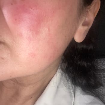 Aktif International Hospital Bahçelievler Aktif Hospital Şikayet