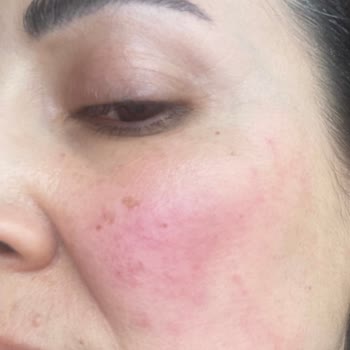 Aktif International Hospital Bahçelievler Aktif Hospital Şikayet