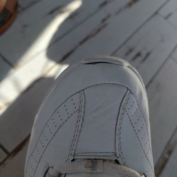 Skechers Güvenimi Boşa Çıkardı