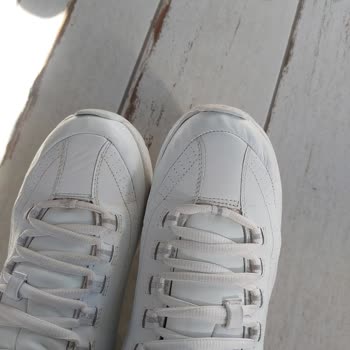 Skechers Güvenimi Boşa Çıkardı