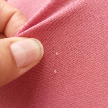 Molfix Bez Sızdırma Ve İçindeki Maddeler Sürekli Dışarısında