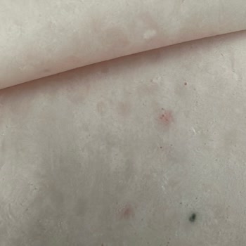 Namet İnsan Sağlığı Elden Gidiyor