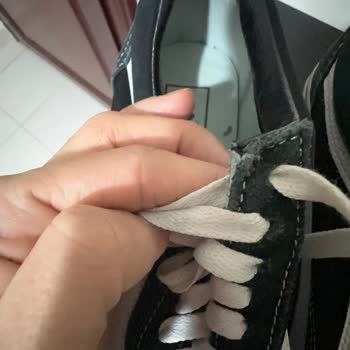 SuperStep Ayakkabı Giyilemez Duruma Geldi