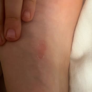 Skechers Ürünün Arkasında Durmayan Firma