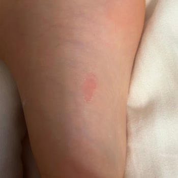 Skechers Ürünün Arkasında Durmayan Firma