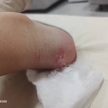 SuperStep Neden Yardımcı Olunmuyor?