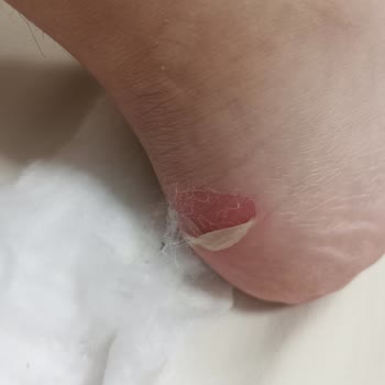 SuperStep Neden Yardımcı Olunmuyor?
