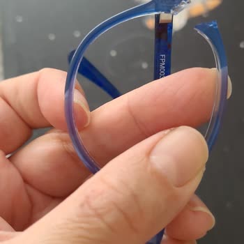 Fisher-Price Kırılan Gözlük Çocuğumun Kaşını Yardı