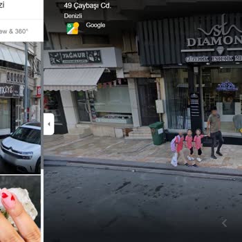 St Diamond Güzellik Merkezi Lazer Epilasyon Şikayeti