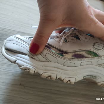 Skechers Markası Ürününün Arkasında Durmadı