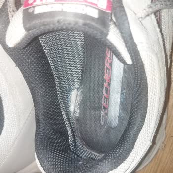 Skechers Ayakkabı Yırtılma Ve Garanti Problemi