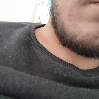 La Roche - Posay La Rock Posay Krem Ve Jel Yüzüm Şiş