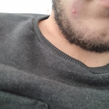 La Roche - Posay La Rock Posay Krem Ve Jel Yüzüm Şiş