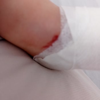 Nevşehir Devlet Hastanesi Hemşire Tavrı