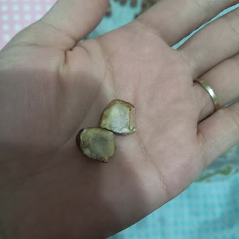 Makbulden Aldığım Fındıkların İçi Küflü Çıktı!