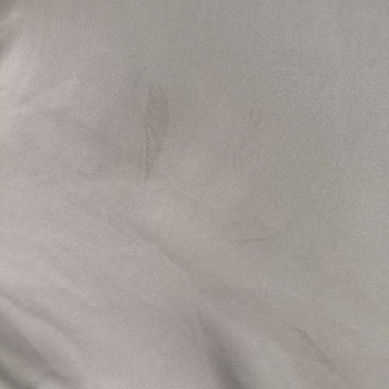 Aslı Çimen Erzincan Mağduriyeti