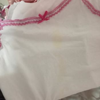 Yumoş Sıvı Deterjan Alerji Yapıyor Şikayetçiyiz