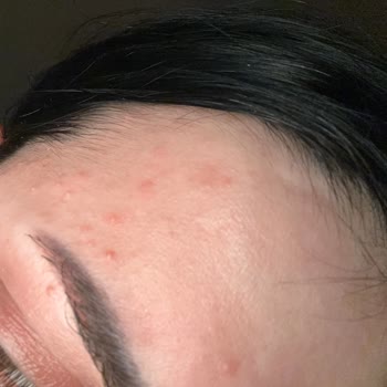 Nivea İnsan Cilt Sağlığına Önem Vermiyor