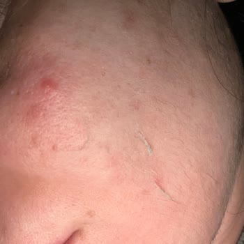 Nivea İnsan Cilt Sağlığına Önem Vermiyor