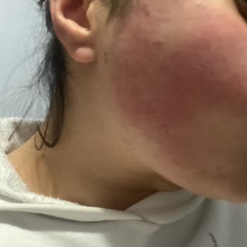 Claderm Arındırıcı Yüz Maskesi