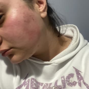 Claderm Arındırıcı Yüz Maskesi