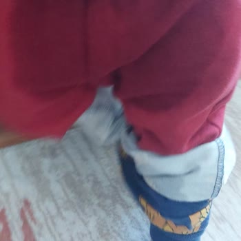 Sleepy Külot Bez Sızdırma Sorunu Ve Kalitesizliği