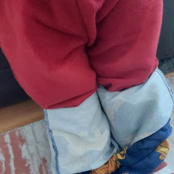 Sleepy Külot Bez Sızdırma Sorunu Ve Kalitesizliği