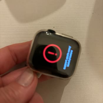 Apple Watch Se 40mm Öldürüp Yenisini Almamı Salamaya Çalıştılar.