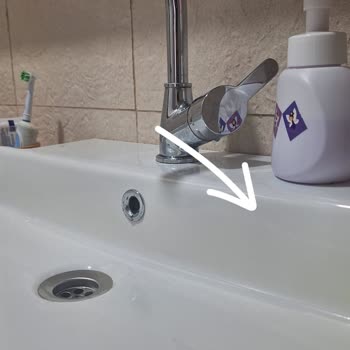 Kale Seramik Lavaboda Sararma Ve Lekeler