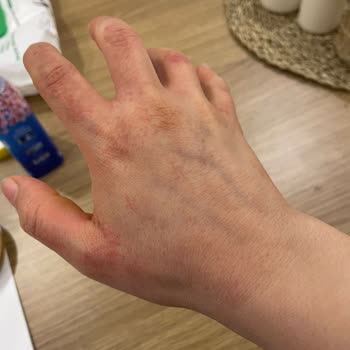 Fairy Bulaşık Deterjanı Ellerimi Mahvetti