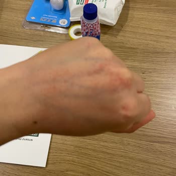 Fairy Bulaşık Deterjanı Ellerimi Mahvetti